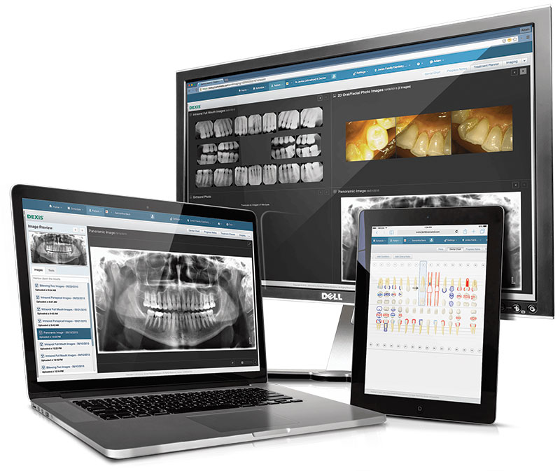 HenrySchein_DEXIS-for-Dentrix-Ascend-WEB