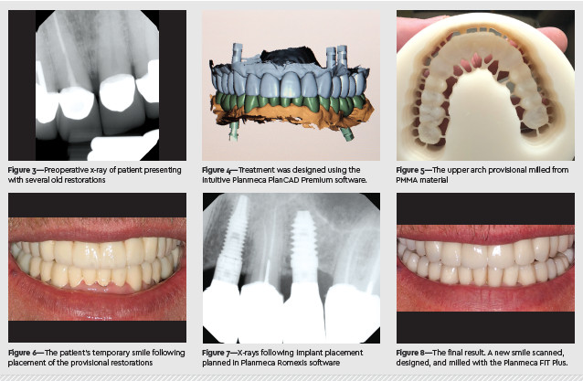 planmeca fit case study