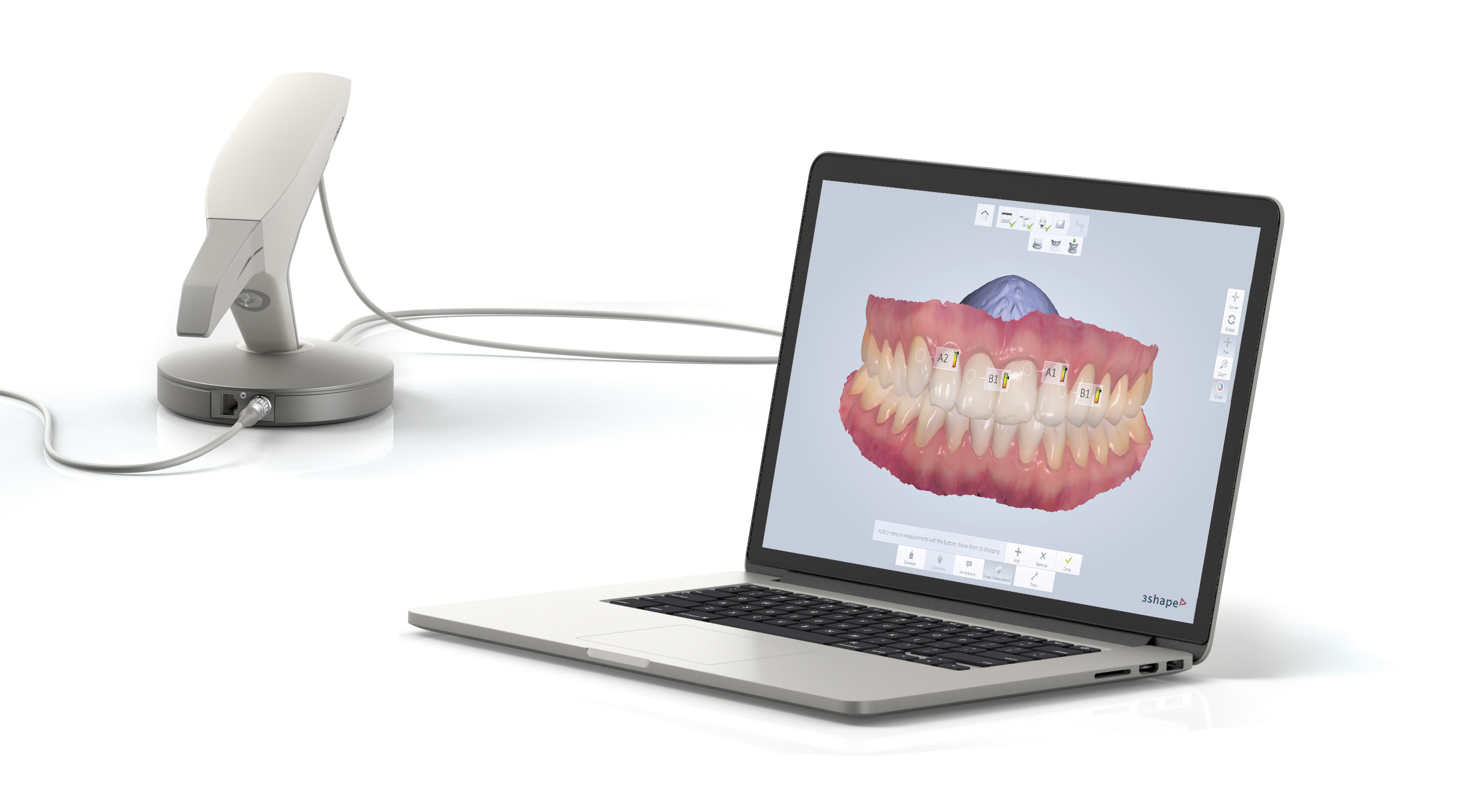 TRIOS Color Digital Impression Solution