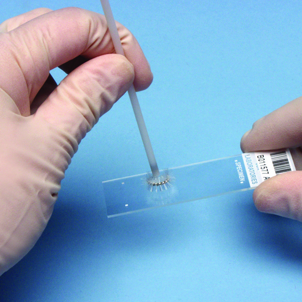 Dental Product Shopper Oral Cancer Detection