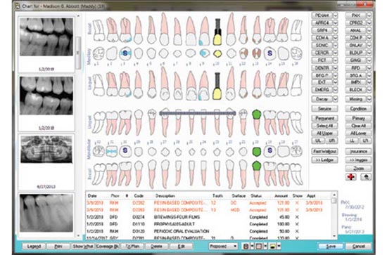 Patterson Eaglesoft Dental Charting