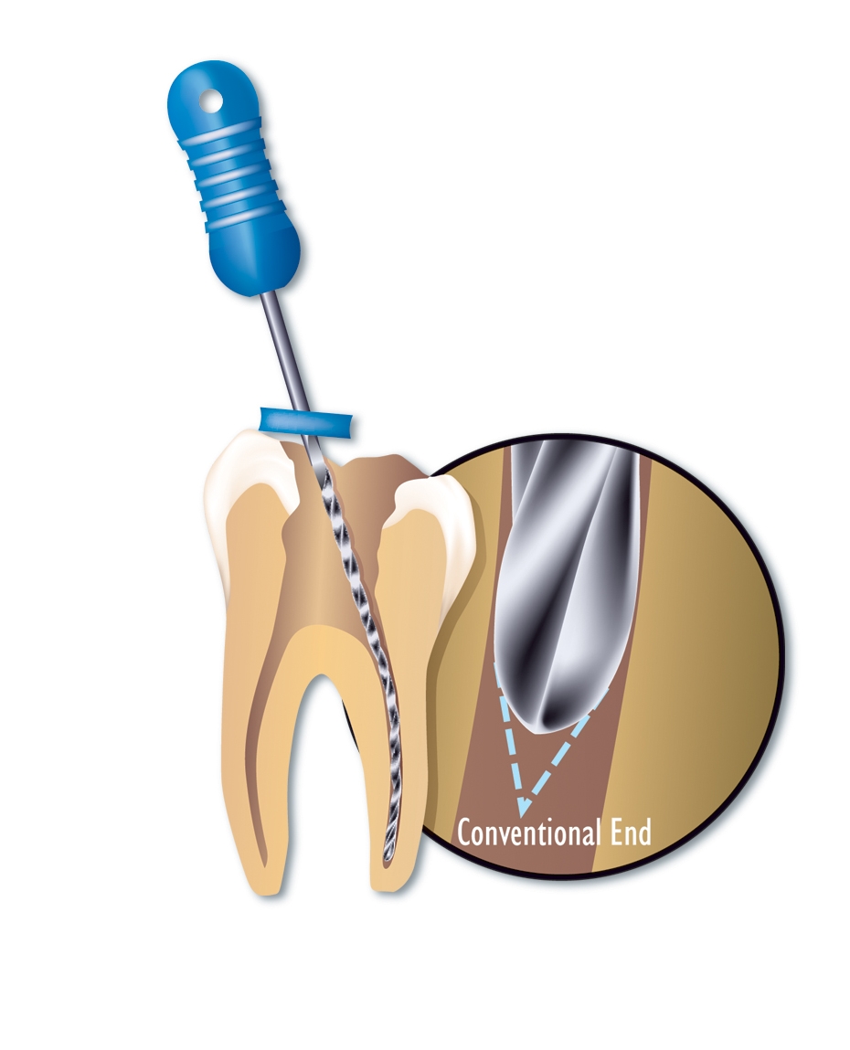 Files & Reamers Premier Dental Products Co.