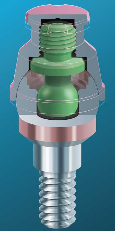 LOCATOR F-Tx Fixed Attachment System
